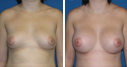 Before & After Photos